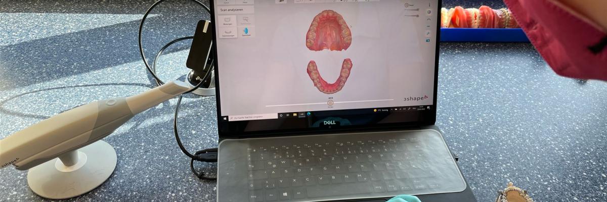 Intraorale Digitalscans für die digitale Auswertung und Therapieplanung